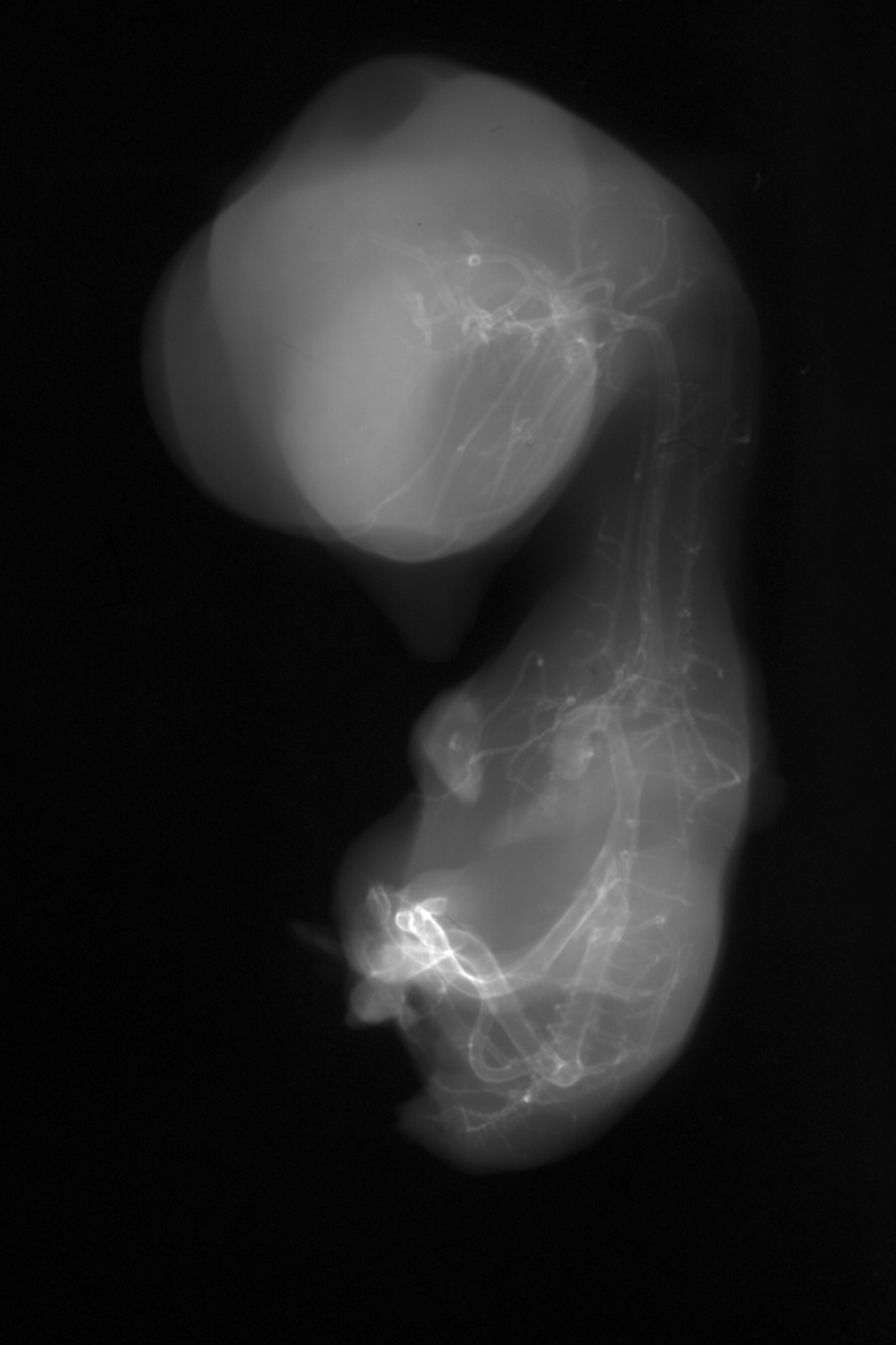 stage 35 chick embryo x-ray